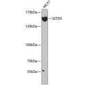 Western blot analysis of extracts of MCF-7 cells, using SETD5 antibody (abx005511) at 1:300 dilution.