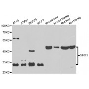 Western blot analysis of extracts of various cell lines, using SIRT3 antibody (abx005514) at 1/1000 dilution.
