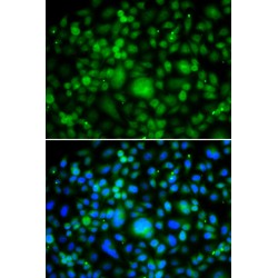 SET And MYND Domain-Containing Protein 3 (SMYD3) Antibody