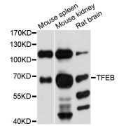 Western blot analysis of extracts of various cell lines, using TFEB antibody (abx005518) at 1:3000 dilution.