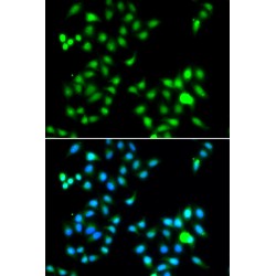 Twist-Related Protein 1 (TWIST1) Antibody