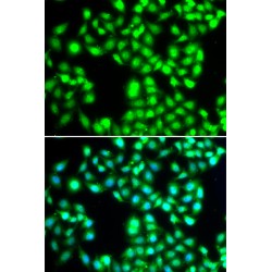 YTH Domain-Containing Protein 1 (YTHDC1) Antibody