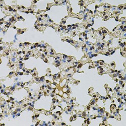 CREB Binding Protein (CREBBP) Antibody