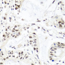 Exonuclease 1 (EXO1) Antibody