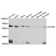 Western blot analysis of extracts of various cell lines, using CCT6A antibody (abx005625) at 1/1000 dilution.