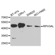 Western blot analysis of extracts of various cell lines, using RPH3AL antibody (abx005626) at 1/1000 dilution.