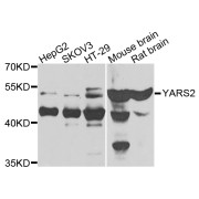 Western blot analysis of extracts of various cell lines, using YARS2 antibody (abx005666) at 1/1000 dilution.