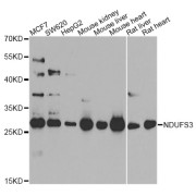 Western blot analysis of extracts of various cell lines, using NDUFS3 antibody (abx005670) at 1/1000 dilution.