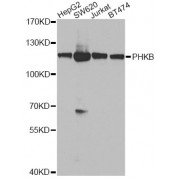 Western blot analysis of extracts of various cell lines, using PHKB antibody (abx005671) at 1/1000 dilution.