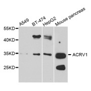 Western blot analysis of extracts of various cell lines, using ACRV1 antibody (abx005679) at 1/1000 dilution.