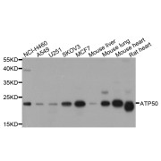 Western blot analysis of extracts of various cell lines, using ATP5O antibody (abx005681) at 1/1000 dilution.