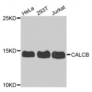 Western blot analysis of extracts of various cell lines, using CALCB antibody (abx005683) at 1/1000 dilution.