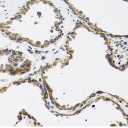 Calcitonin Gene Related Peptide 2 / CGRP2 (CALCB) Antibody