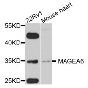 Western blot analysis of extracts of various cell lines, using MAGEA6 antibody (abx005697) at 1/1000 dilution.