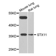 Western blot analysis of extracts of various cell lines, using STX11 antibody (abx005715) at 1/1000 dilution.