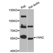 Western blot analysis of extracts of various cell lines, using VNN2 antibody (abx005716) at 1/1000 dilution.