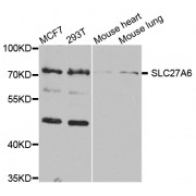 Western blot analysis of extracts of various cell lines, using SLC27A6 antibody (abx005736) at 1/1000 dilution.