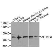 Western blot analysis of extracts of various cell lines, using ALOXE3 antibody (abx005761) at 1/1000 dilution.