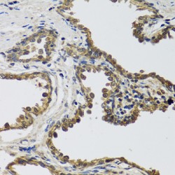 Interleukin 25 (IL25) Antibody