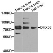 Western blot analysis of extracts of various cell lines, using DHX58 antibody (abx005768) at 1/1000 dilution.