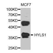 Western blot analysis of extracts of MCF-7 cells, using HYLS1 antibody (abx005785) at 1/1000 dilution.