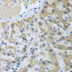 Xeroderma Pigmentosum, Complementation Group C (XPC) Antibody