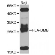 Western blot analysis of extracts of Raji cells, using HLA-DMB antibody (abx005818) at 1/1000 dilution.