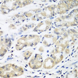 HLA Class II Histocompatibility Antigen, DM Beta Chain (HLA-DMB) Antibody