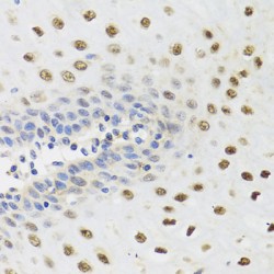 YTH Domain Family Protein 3 (YTHDF3) Antibody