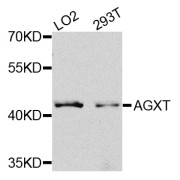 Western blot analysis of extracts of various cell lines, using AGXT antibody (abx005823) at 1/1000 dilution.