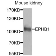 Western blot analysis of extracts of mouse kidney, using EPHB1 antibody (abx005830) at 1/1000 dilution.