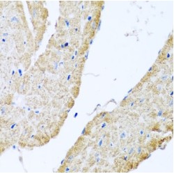 Cytochrome C Oxidase Subunit 6B1 (COX6B1) Antibody