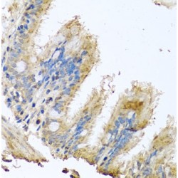 Cytochrome C Oxidase Subunit 6B1 (COX6B1) Antibody