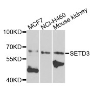 Western blot analysis of extracts of various cell lines, using SETD3 antibody (abx005892) at 1/1000 dilution.