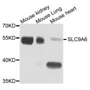 Western blot analysis of extracts of various cell lines, using SLC9A6 antibody (abx005899) at 1/1000 dilution.