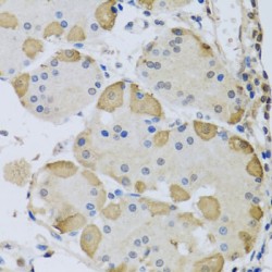 Anaphase-Promoting Complex Subunit 10 (ANAPC10) Antibody