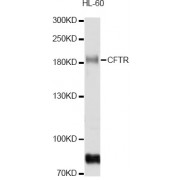 Western blot analysis of extracts of HL-60 cells, using CFTR antibody (abx005919) at 1/1000 dilution.