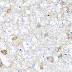 Bone Morphogenetic Protein 5 (BMP5) Antibody