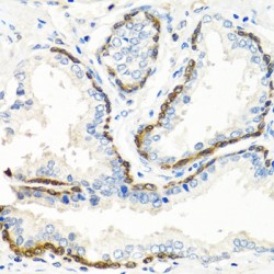 Bone Morphogenetic Protein 5 (BMP5) Antibody