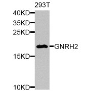 Western blot analysis of extracts of 293T cells, using Pro-GNRH2 antibody (abx005925) at 1/1000 dilution.