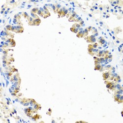 Progonadoliberin 2 (GNRH2) Antibody