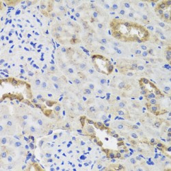 Hexokinase 3 (HK3) Antibody