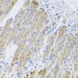 Probable Arginine-tRNA Ligase, Mitochondrial (RARS2) Antibody