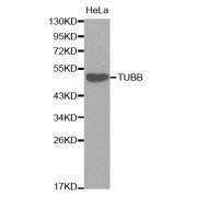 Western blot analysis of extracts of HeLa cells, using TUBB antibody (abx005943).