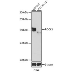 Rho-Associated Protein Kinase 1 (ROCK1) Antibody