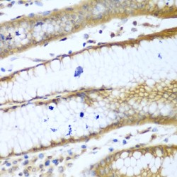 Rho-Associated Protein Kinase 1 (ROCK1) Antibody