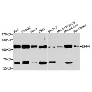 Western blot analysis of extracts of various cell lines, using DPP4 antibody (abx005954) at 1/1000 dilution.