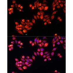 Heparanase (HPSE) Antibody