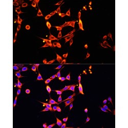 Heparanase (HPSE) Antibody