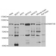 Western blot analysis of extracts of various cell lines, using DNMT3B antibody (abx006005) at 1/1000 dilution.
